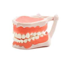 TIRTCIII-TIPODONTO-CLASE-III-1